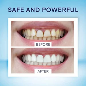 Asavea Smile Teeth Whitening Pen (4 Pens) For Teeth Whitening, 40+ Uses, Effective, Painless, No Sensitivity, Travel-Friendly, Beautiful White Smile,