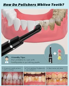Tooth Polisher, Rechargeable Tooth Whitening Kit For Teeth Cleaning And Whitening, With 3 Tooth Polish Paste And 5 Brush Heads, Led Light, Easy To Us