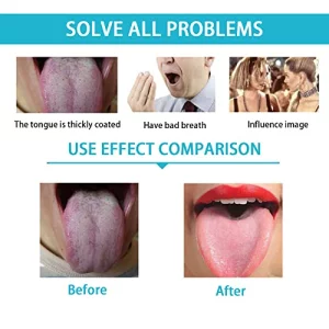 Yiwafu 2 Pack Tongue Scraper,Stainless Steel Tongue Cleaners,Tongue Scraper For Adults, Reduce Bad Breath And Fresh Breath(Silver)