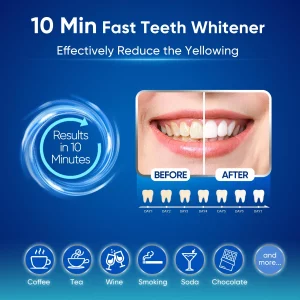Mysmile Teeth Whitening Kit For Sensitive Teeth With Led Light, 10 Min Non-Sensitive Fast Teeth Whitener, 3 Carbamide Peroxide Teeth Whitening Gel, E