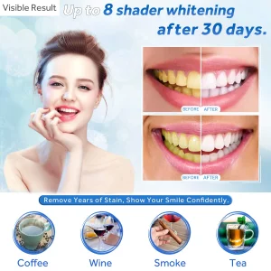 Ezgo 10 Pack Teeth Whitening Gel Refills 22% Bleaching Gel, No Sensitive Teeth Whitener, Great For Sensitive Tooth Whitening, Carbamide Peroxide Teet